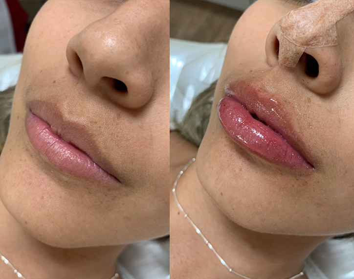 Antes-e-depois-angelica-2