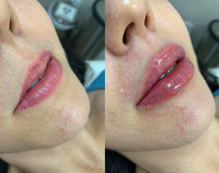 Antes-e-depois-angelica-3